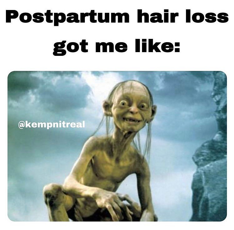 lindsay lohan gollum - Postpartum hair loss got me