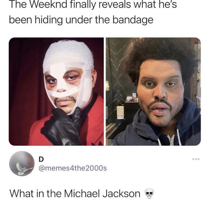 head - The Weeknd finally reveals what he's been hiding under the bandage D 2000s What in the Michael Jackson