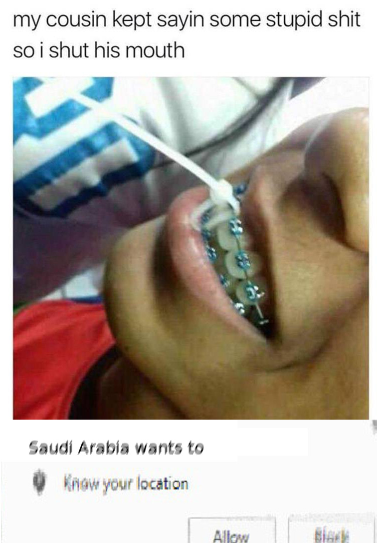 dank meme of person who zip-tied his cousins braces shut and Saudi Arabia wants to know his location