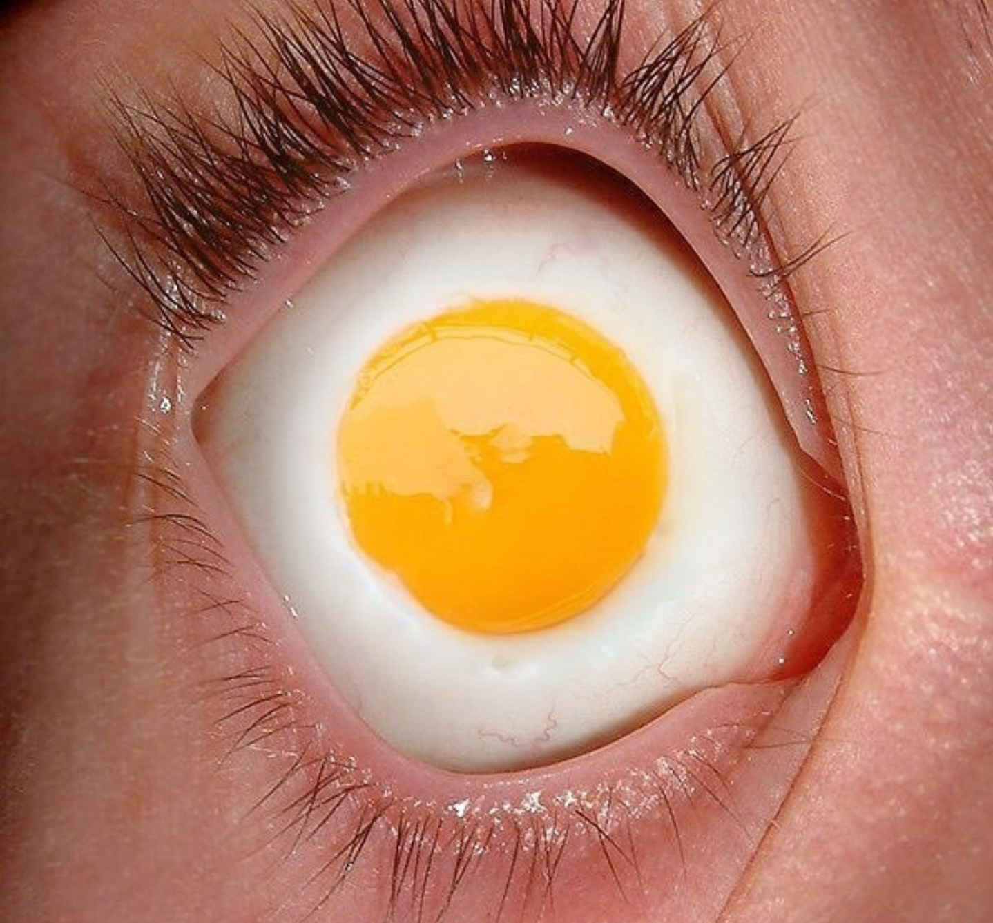 egg contact lenses