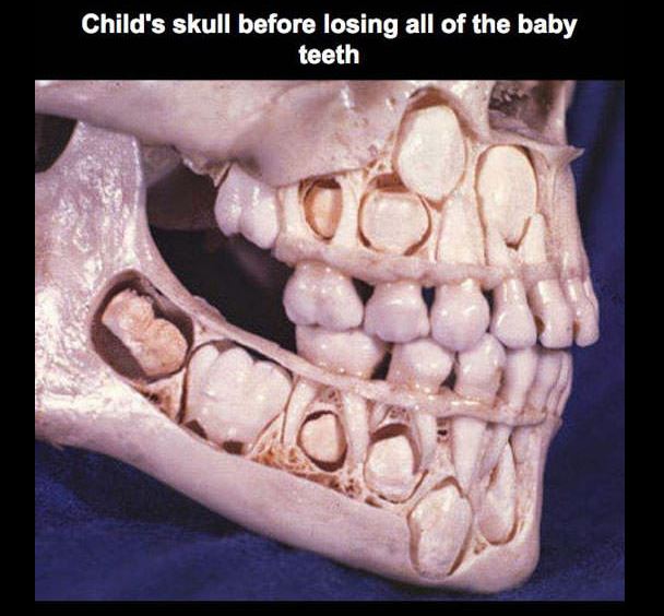 baby teeth and adult teeth - Child's skull before losing all of the baby teeth