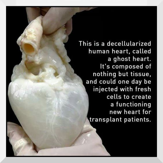 meme of heart completely drained of blood - This is a decellularized human heart, called a ghost heart. It's composed of nothing but tissue, and could one day be injected with fresh cells to create a functioning new heart for transplant patients.