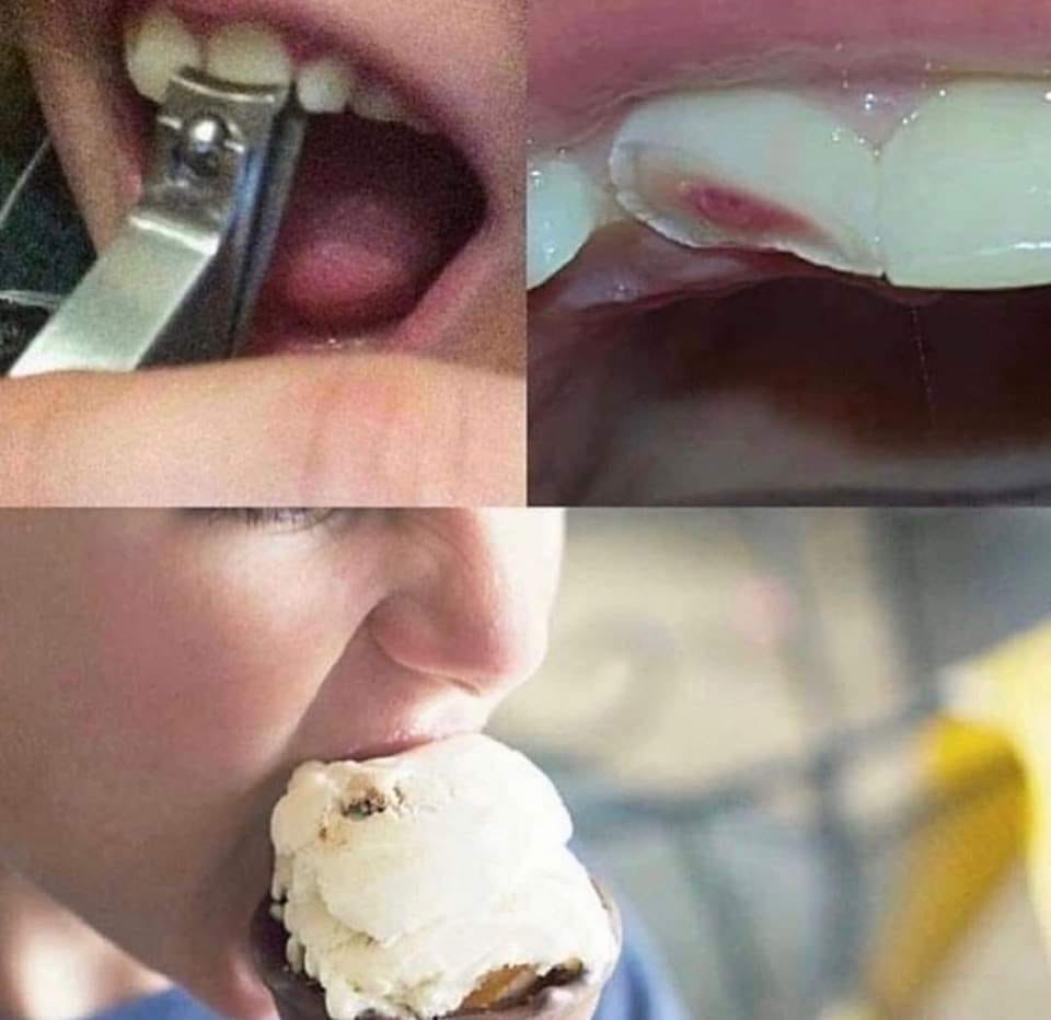 tooth clippers ice cream