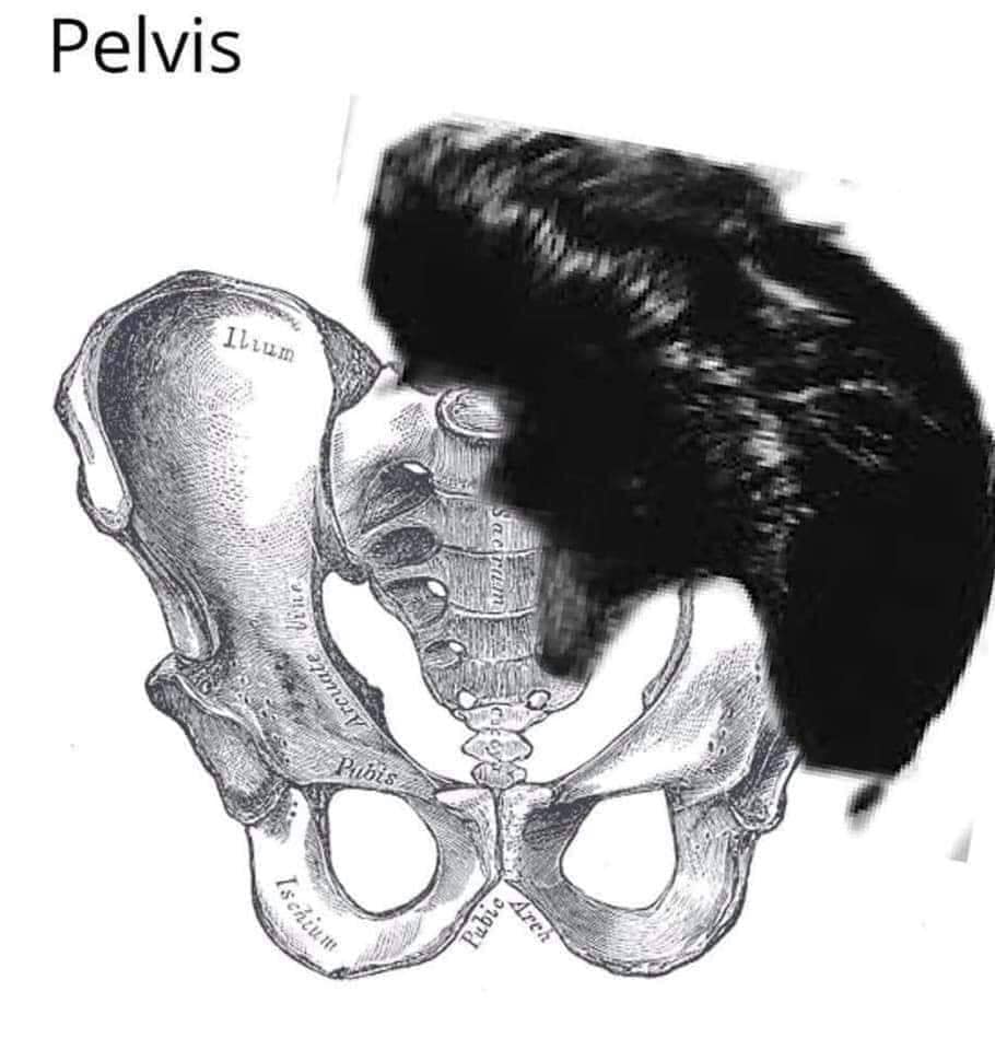 pelvic bone - Pubic rculate Ischil it! Illum Pelvis