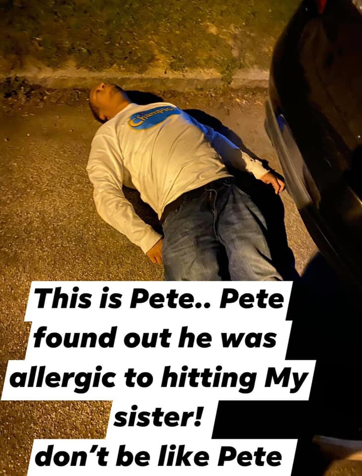 ep - This is Pete.. Pete found out he was allergic to hitting My sister! don't be Pete
