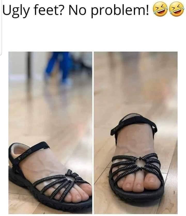sandals with feet - Ugly feet? No problem!