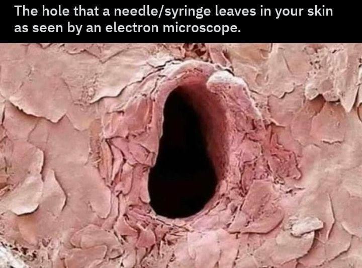 needle in skin under microscope - The hole that a needlesyringe leaves in your skin as seen by an electron microscope.