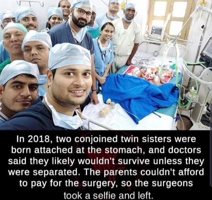 two conjoined twin sisters 2018 - In 2018, two conjoined twin sisters were born attached at the stomach, and doctors said they ly wouldn't survive unless they were separated. The parents couldn't afford to pay for the surgery, so the surgeons took a selfi