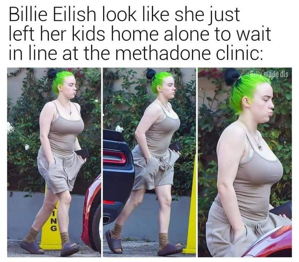 shoulder - Billie Eilish look she just left her kids home alone to wait in line at the methadone clinic palio made dis Zu