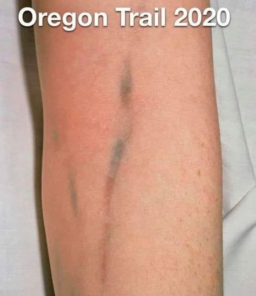 human leg - Oregon Trail 2020