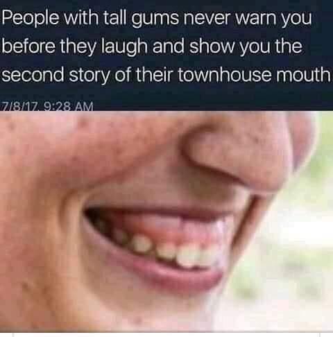 tall gums - People with tall gums never warn you before they laugh and show you the second story of their townhouse mouth 7817