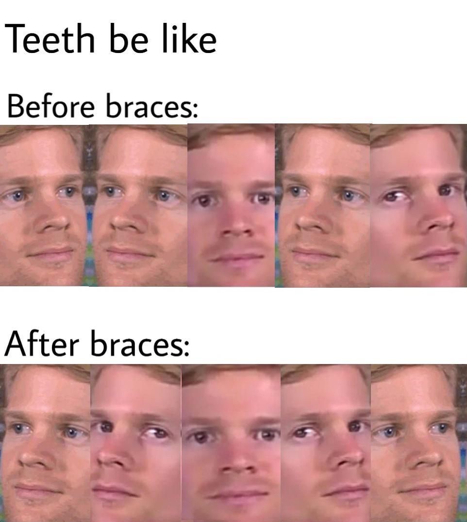 braces meme - Teeth be Before braces After braces