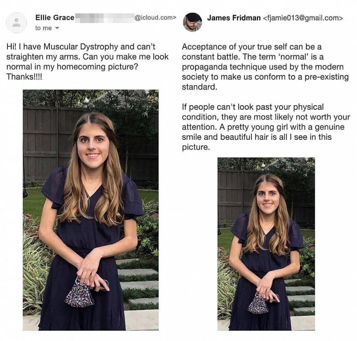 dress - .com> James Fridman  Ellie Grace to me Hi! I have Muscular Dystrophy and can't straighten my arms. Can you make me look normal in my homecoming picture? Thanks!!!! Acceptance of your true self can be a constant battle. The term 'normal' is a…