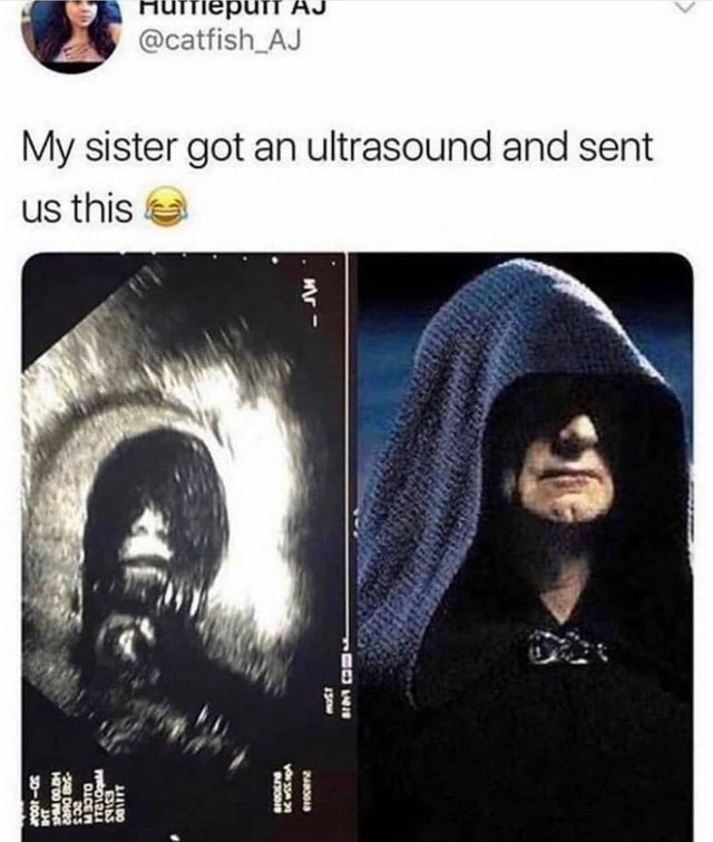 fresh randoms --  my sister got an ultrasound and sent us this - iepuT Aj Uit My sister got an ultrasound and sent us this O must Sim C Sigden yosan Crn