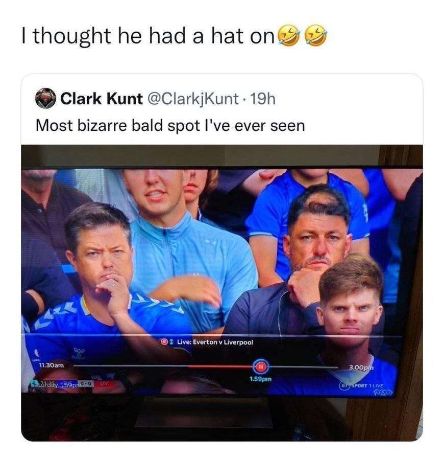 funny memes and pics - fun - I thought he had a hat on O Clark Kunt . 19h Most bizarre bald spot I've ever seen 11.30am Saturday 159pm0 Liv Live Everton v Liverpool 1.59pm 3.00pm By Sport 1 Live Toa
