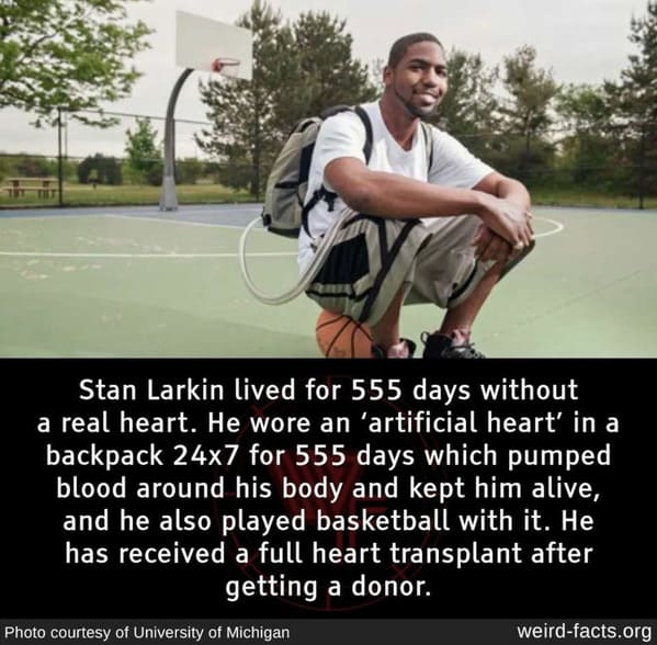 funny randoms - man lives without heart - Stan Larkin lived for 555 days without a real heart. He wore an 'artificial heart' in a backpack 24x7 for 555 days which pumped blood around his body and kept him alive, and he also played basketball with it. He h