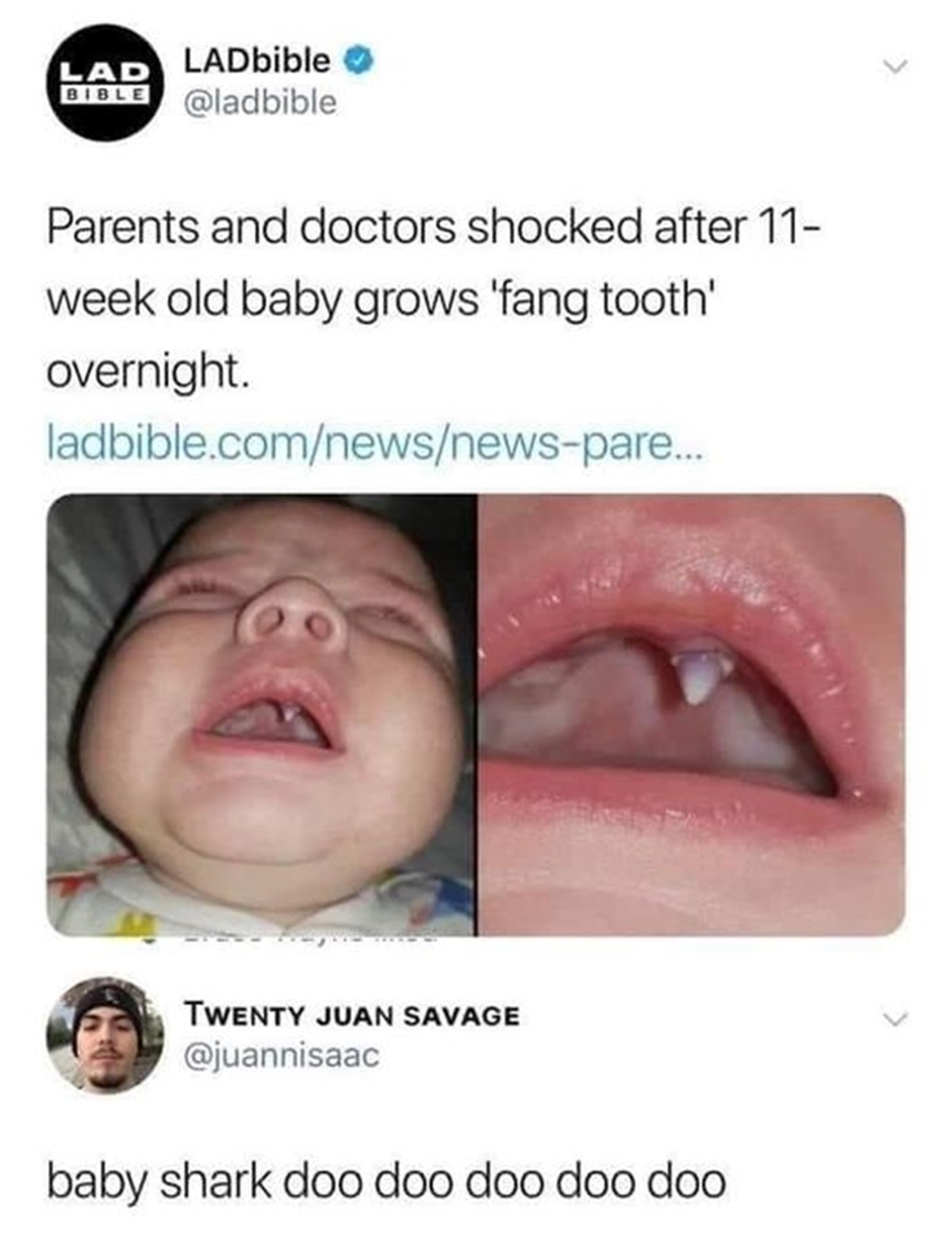 Meme - Lad LADbible Bible Parents and doctors shocked after 11 week old baby grows 'fang tooth' overnight. ladbible.comnewsnewspare... Twenty Juan Savage baby shark doo doo doo doo doo L