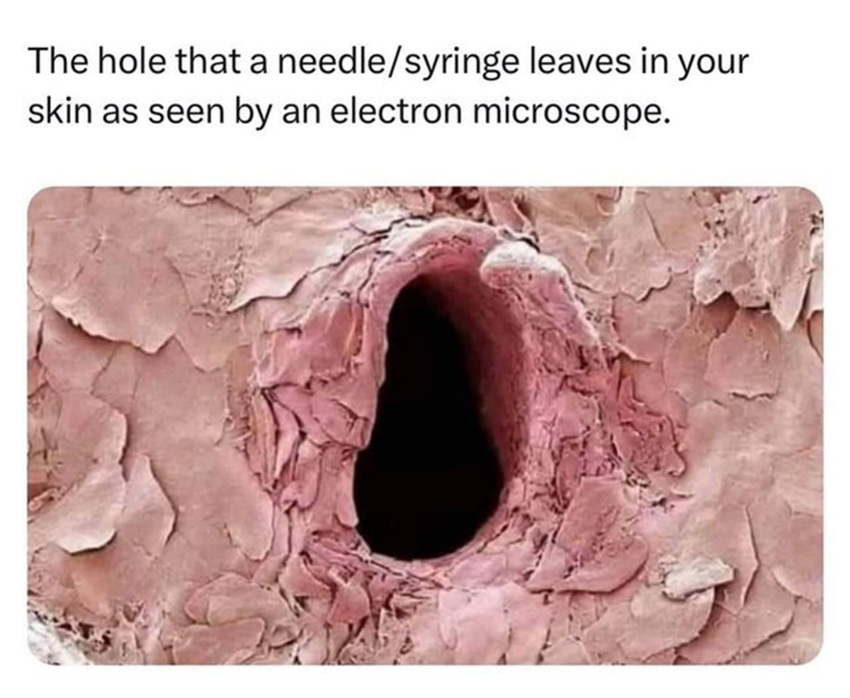 microscopic needle hole - The hole that a needlesyringe leaves in your skin as seen by an electron microscope.