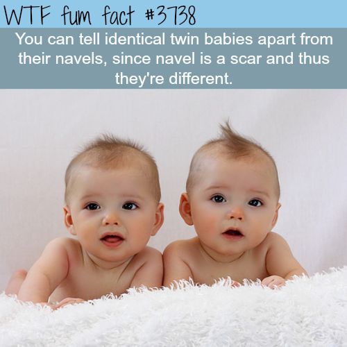 wtf facts - fun facts about babies - Wtf fum fact You can tell identical twin babies apart from their navels, since navel is a scar and thus they're different.