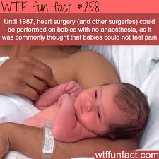 wtf facts - infant - Wtf fun fact Until 1987, heart surgery and other surgeries could be performed on babies with no anaesthesia, as it was commonly thought that babies could not feel pain wtffunfact.com