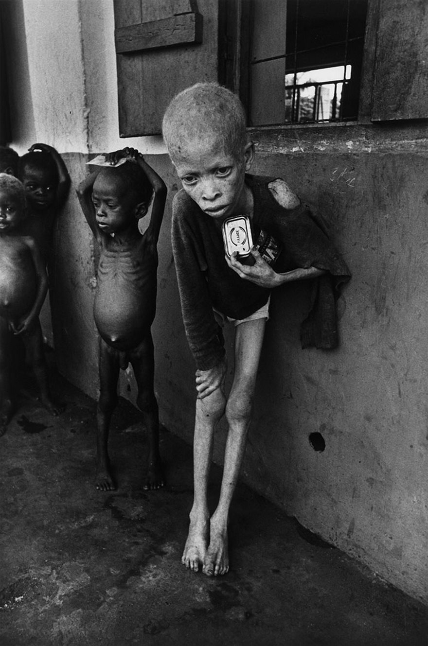 Albino Boy, Biafra, Don Mccullin, 1969

Few remember Biafra, the tiny western African nation that split off from southern Nigeria in 1967 and was retaken less than three years later. Much of the world learned of the enormity of that brief struggle through images of the mass starvation and disease that took the lives of possibly millions. None proved as powerful as British war photographer Don McCullin’s picture of a 9-year-old albino child. “To be a starving Biafran orphan was to be in a most pitiable situation, but to be a starving albino Biafran was to be in a position beyond description,” McCullin wrote. “Dying of starvation, he was still among his peers an object of ostracism, ridicule and insult.” This photo profoundly influenced public opinion, pressured governments to take action, and led to massive airlifts of food, medicine and weapons. McCullin hoped that such stark images would be able to “break the hearts and spirits of secure people.” While public attention eventually shifted, McCullin’s work left a lasting legacy: he and other witnesses of the conflict inspired the launch of Doctors Without Borders, which delivers emergency medical support to those suffering from war, epidemics and disasters.