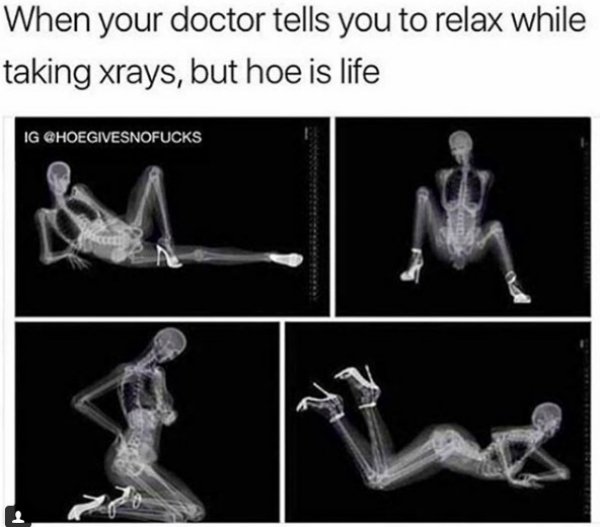 A dank and dirty meme of an x-ray of a woman in sexy positions.