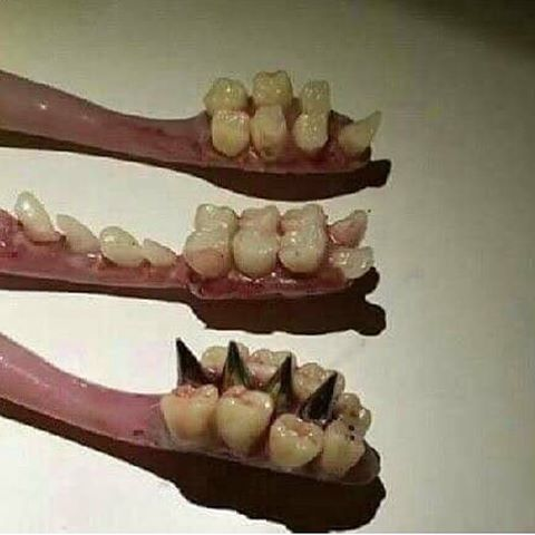 A weird, strange, cursed picture of teeth on a toothbrush. 