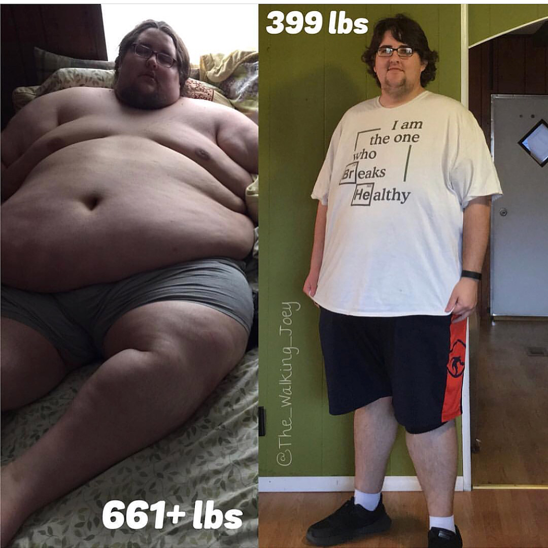 weight loss shoulder - 399 lbs I am the one who Breaks Healthy The Walking Joey 661 lbs