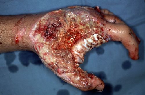 A Gallery Of Gruesome Diseases