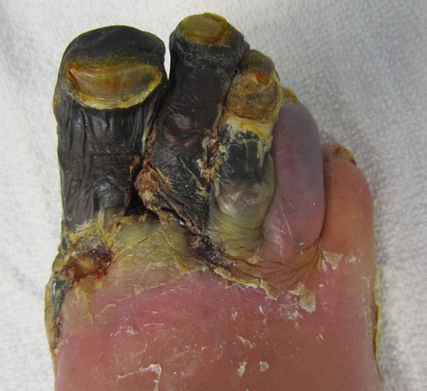 A Gallery Of Gruesome Diseases