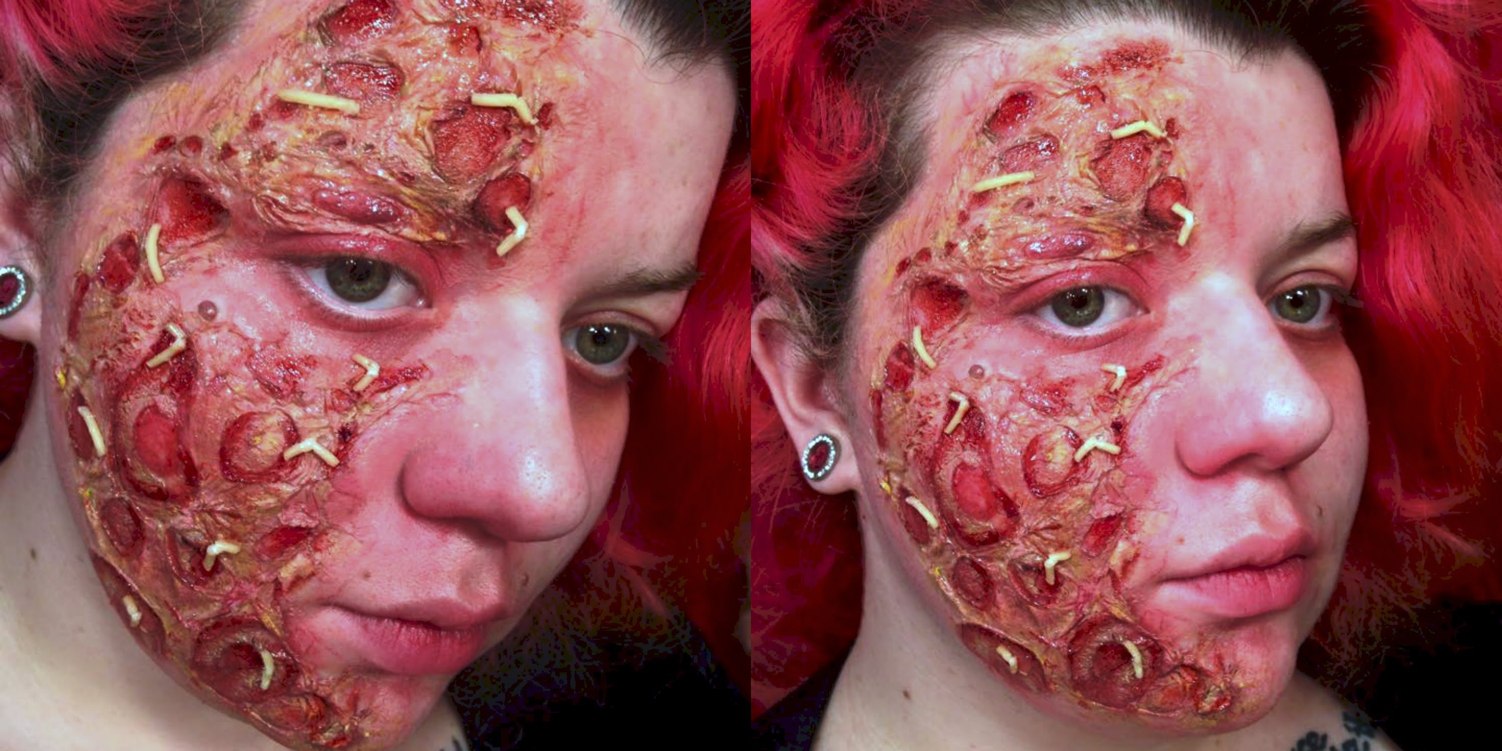 A Gallery Of Gruesome Diseases