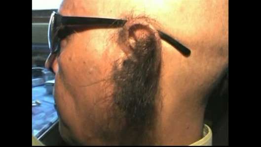 A Sweet Gallery Of Disgusting Human Hair