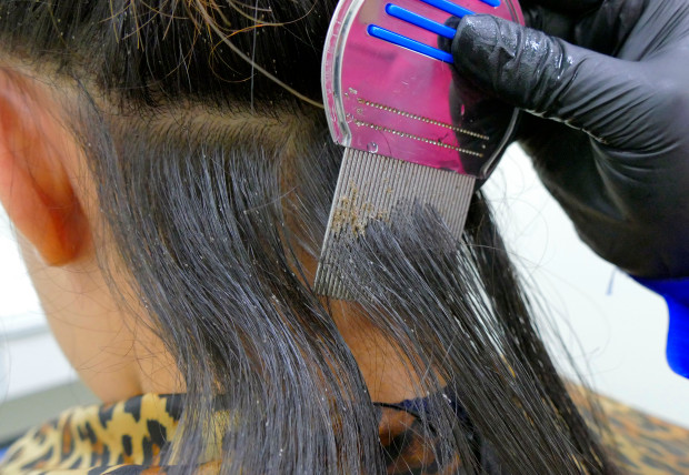 A Sweet Gallery Of Disgusting Human Hair