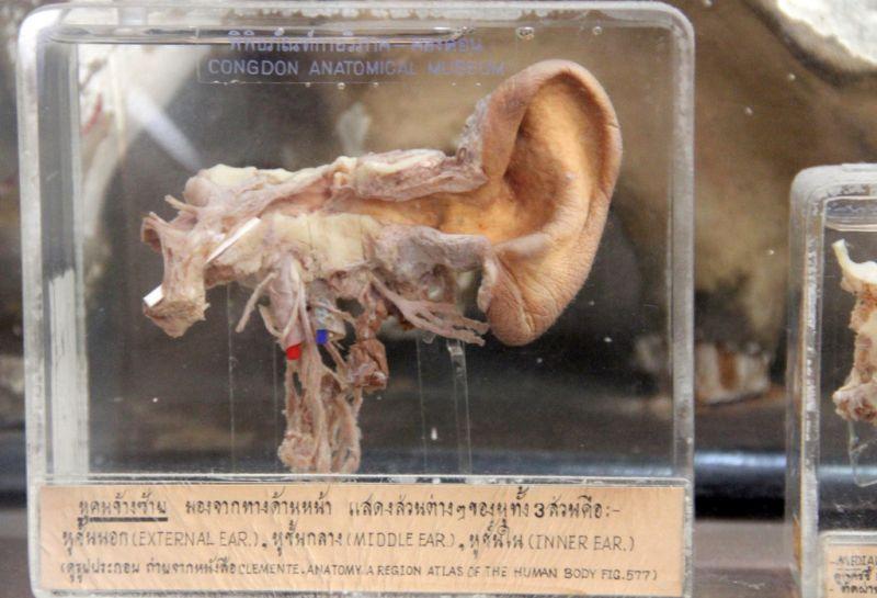 congdon anatomical museum