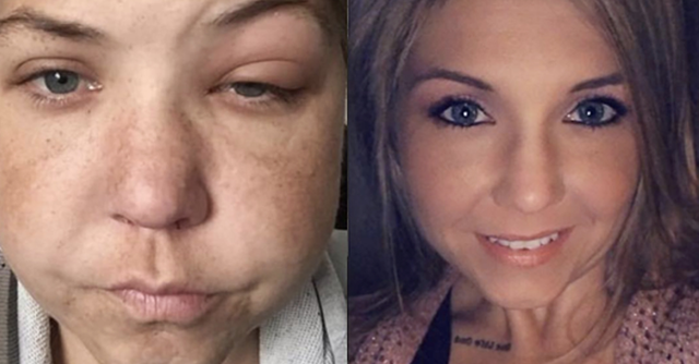 15 People Before and After They Gave Up Alcohol