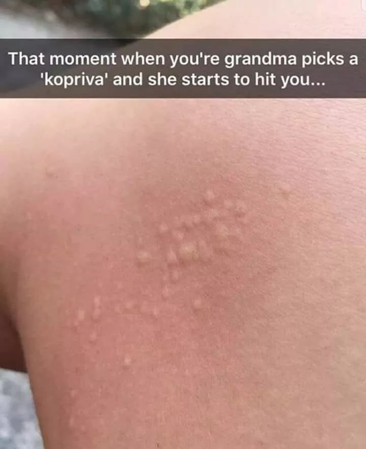 close up - That moment when you're grandma picks a 'kopriva' and she starts to hit you...