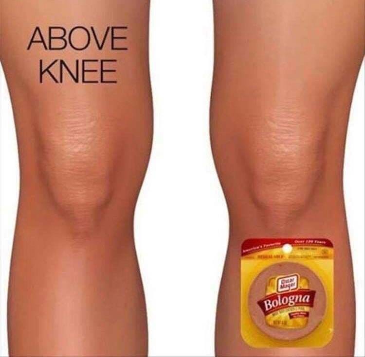 knee joke