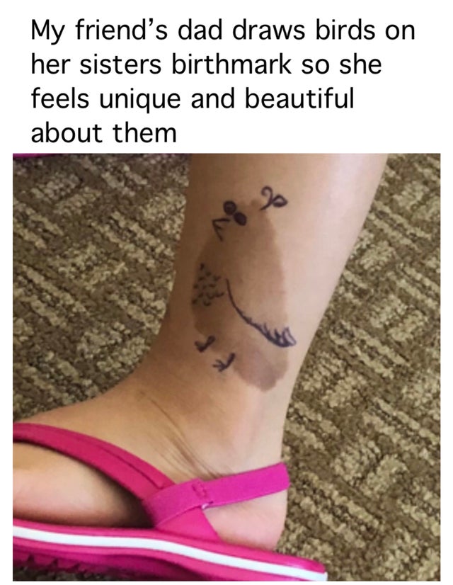 human leg - My friend's dad draws birds on her sisters birthmark so she feels unique and beautiful about them