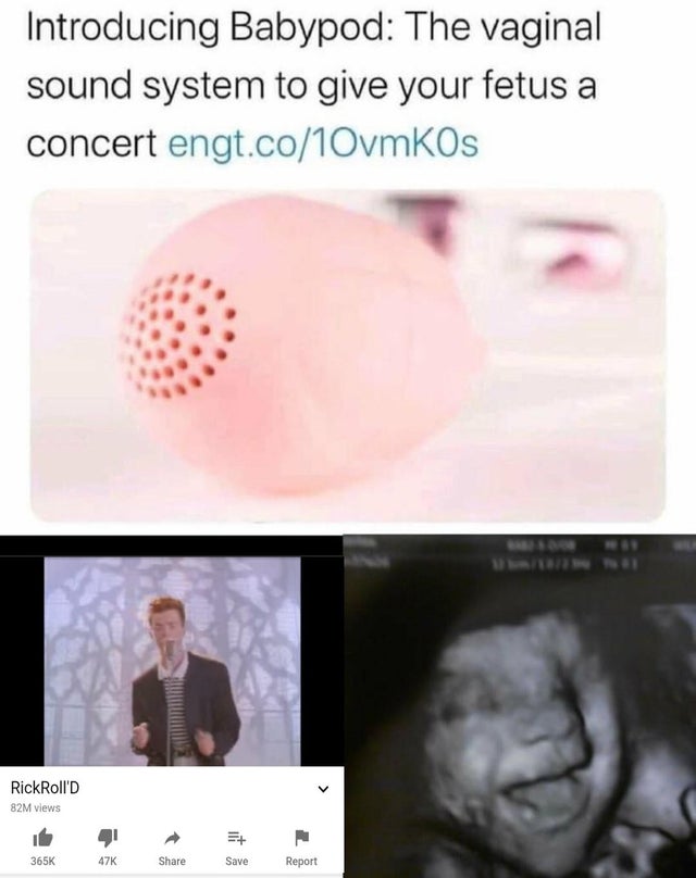 introducing babypod - Introducing Babypod The vaginal sound system to give your fetus a concert engt.co10vmKos RickRoll's 82M views ut 47K Save Report