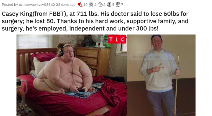 1 ton man - 10 Posted by uthrowawayyy08642 23 days ago 44357 Casey Kingfrom Fbbt, at 711 lbs. His doctor said to lose 60lbs for surgery; he lost 80. Thanks to his hard work, supportive family, and surgery, he's employed, independent and under 300 lbs! Et 