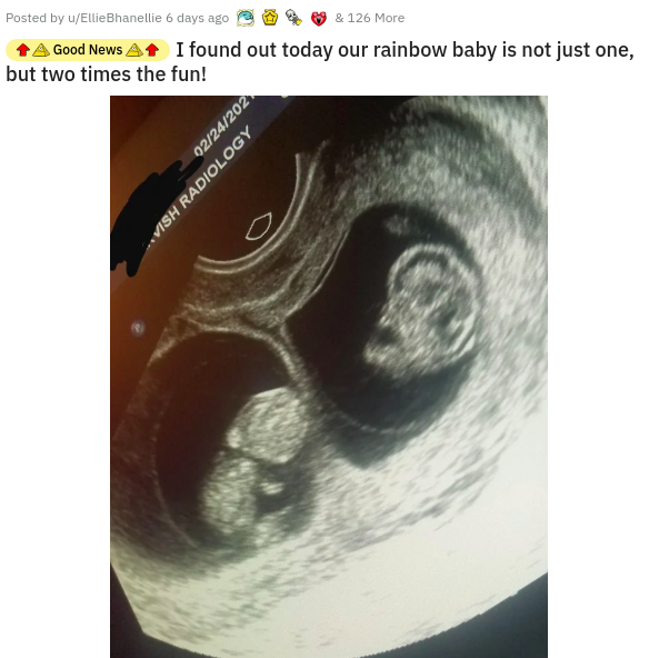 jaw - Posted by uEllie Bhanellie 6 days ago & 126 More Good News I found out today our rainbow baby is not just one, but two times the fun! 0224202 Vish Radiology