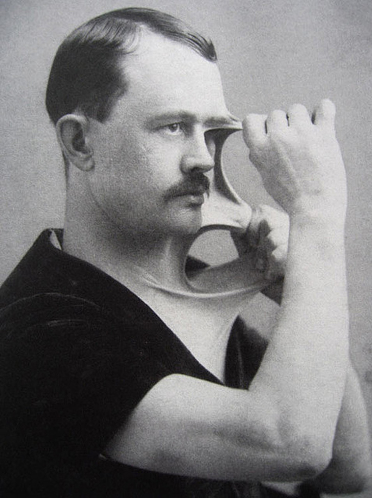 Felix Wehrle — a man with incredibly stretchy skin, early 1900’s