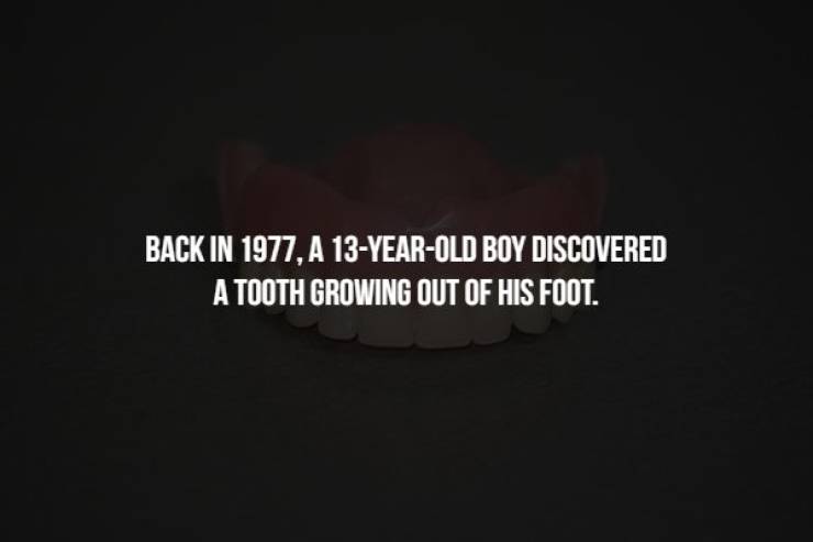 computer wallpaper - Back In 1977, A 13YearOld Boy Discovered A Tooth Growing Out Of His Foot.