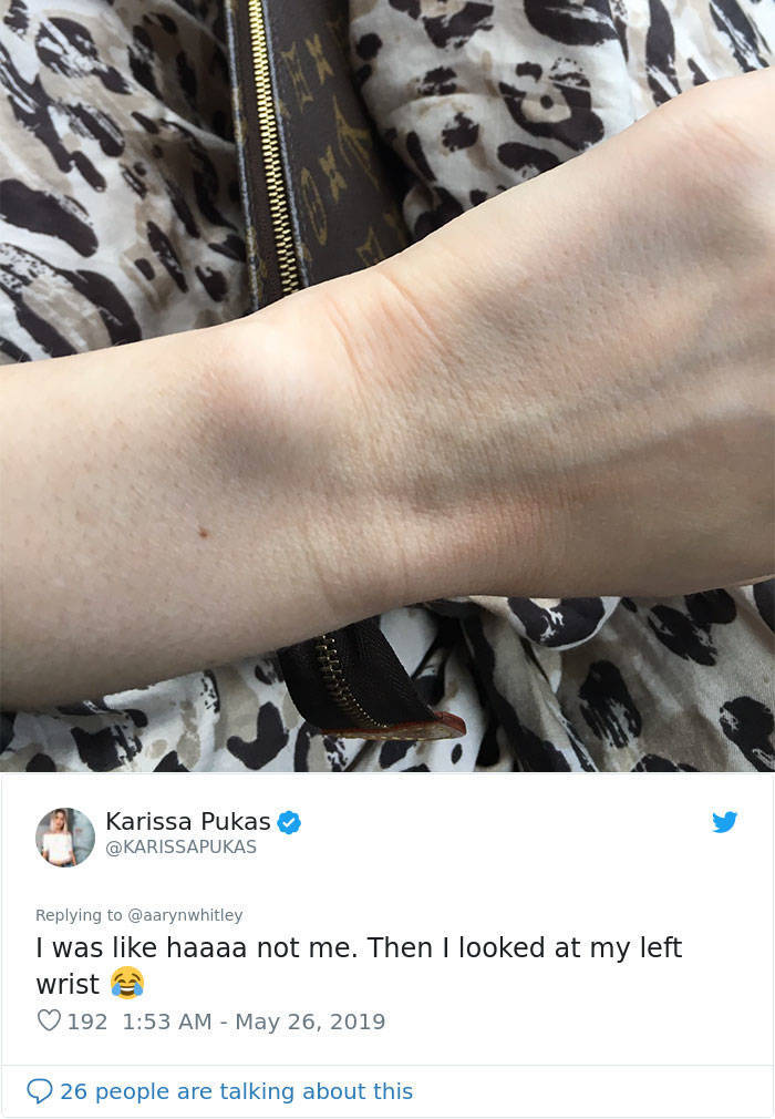 girl freckle wrist - Karissa Pukas I was haaaa not me. Then I looked at my left wrist 192