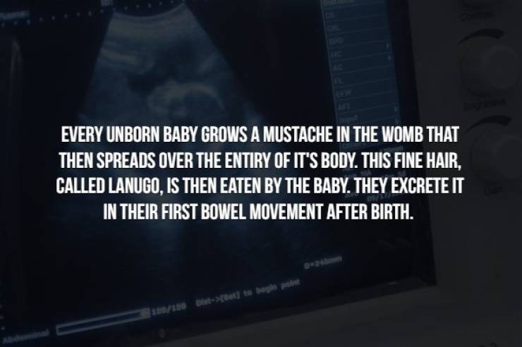 multimedia - Every Unborn Baby Grows A Mustache In The Womb That Then Spreads Over The Entiry Of It'S Body. This Fine Hair. Called Lanugo, Is Then Eaten By The Baby. They Excrete It In Their First Bowel Movement After Birth. >fette 1610
