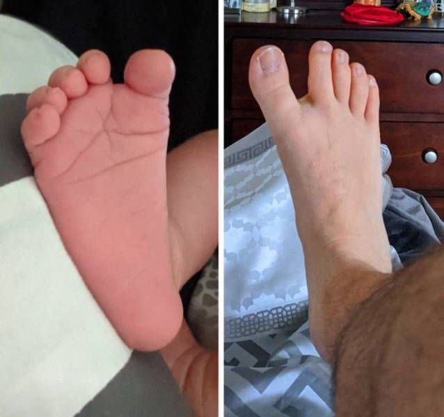 “My wife just gave birth to our firstborn, and me and my son both have the same weird genetic abnormality where we have an extra-large space between our first and second toes.”