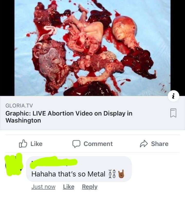 photo caption - Gloria.Tv Graphic Live Abortion Video on Display in Washington Comment Hahaha that's so Metal 28 Just now