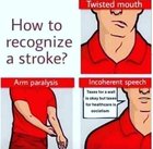 recognize a stroke - Twisted mouth How to recognize a stroke? Arm paralysis 5