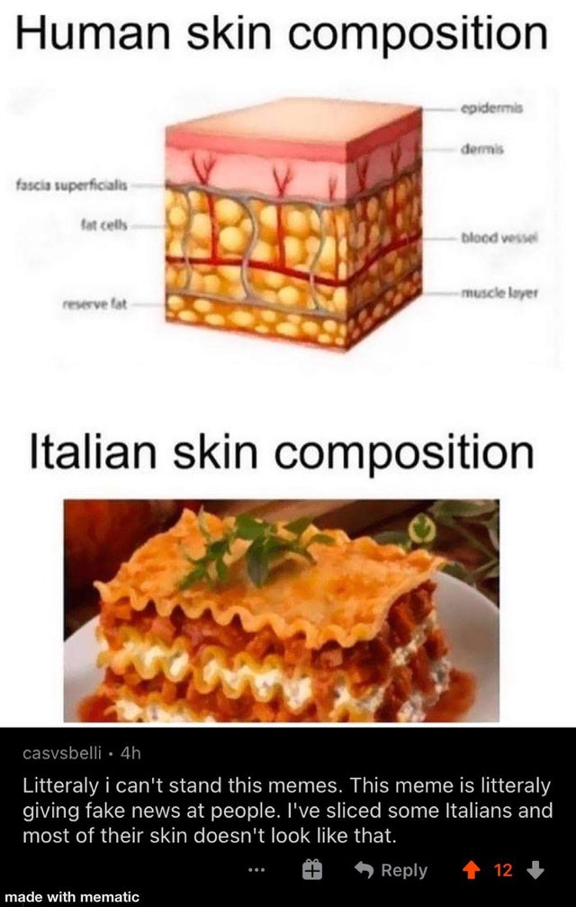 italian memes - Human skin composition epidermis dermis fascia superficialis tot cells blood vessel muscle layer reserve Italian skin composition casvsbelli. 4h Litteraly i can't stand this memes. This meme is litteraly giving fake news at people. I've sl