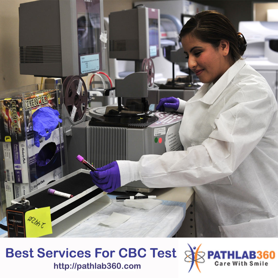 - services find Ouch -Pathlab360 How ... best Test to for CBC